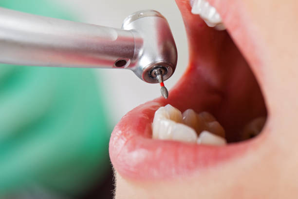 Best Chipped Tooth Repair Near Me  in Bohners Lake, WI